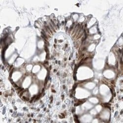 Invitrogen WHIP Polyclonal Antibody 100 &mu;L; Unconjugated:Antibodies,