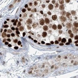 Invitrogen WHIP Polyclonal Antibody 100 &mu;L; Unconjugated:Antibodies,