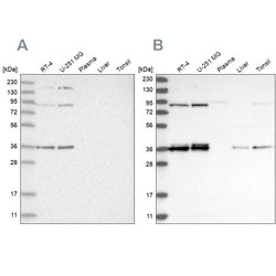 Invitrogen WHIP Polyclonal Antibody 100 &mu;L; Unconjugated:Antibodies,