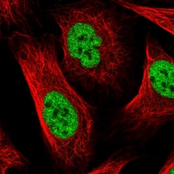 Invitrogen WHIP Polyclonal Antibody 100 &mu;L; Unconjugated:Antibodies,