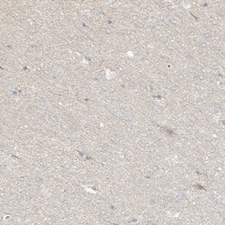 Invitrogen UPK1B Polyclonal Antibody 100 &mu;L | Buy Online | Invitrogen&trade; | Fisher Scientific