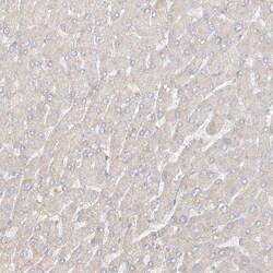 Invitrogen UPK1B Polyclonal Antibody 100 &mu;L | Buy Online | Invitrogen&trade; | Fisher Scientific