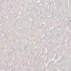 Invitrogen UPK1B Polyclonal Antibody 100 &mu;L | Buy Online | Invitrogen&trade; | Fisher Scientific