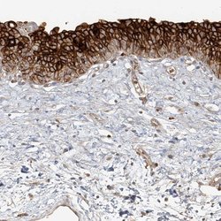 Invitrogen UPK1B Polyclonal Antibody 100 &mu;L | Buy Online | Invitrogen&trade; | Fisher Scientific