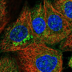 Invitrogen ZDHHC9 Polyclonal Antibody 100 &mu;L; Unconjugated:Antibodies,