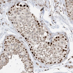 Invitrogen AURKAIP1 Polyclonal Antibody 100 &mu;L; Unconjugated:Antibodies,
