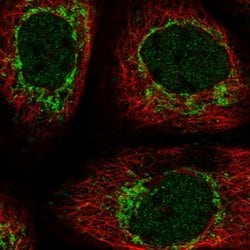 Invitrogen C6orf57 Polyclonal Antibody 100 &mu;L; Unconjugated:Antibodies,