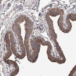 Invitrogen C6orf57 Polyclonal Antibody 100 &mu;L; Unconjugated:Antibodies,