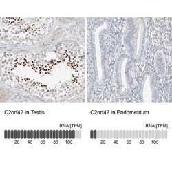 Invitrogen C2orf42 Polyclonal Antibody 100 &mu;L; Unconjugated:Antibodies,