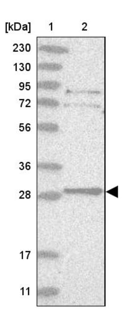Invitrogen TXNDC9 Polyclonal Antibody 100 &mu;L; Unconjugated:Antibodies,