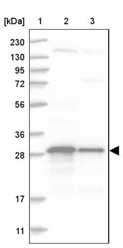 Invitrogen TXNDC9 Polyclonal Antibody 100 &mu;L; Unconjugated:Antibodies,