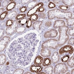Invitrogen ATP6V1B1 Polyclonal Antibody 100 &mu;L; Unconjugated:Antibodies,