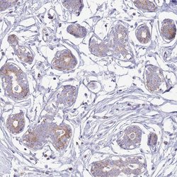 Invitrogen ATP6V1B1 Polyclonal Antibody 100 &mu;L; Unconjugated:Antibodies,