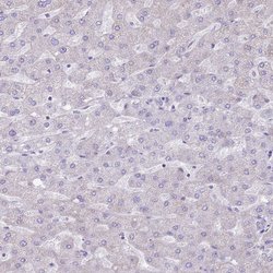 Invitrogen ATP6V1B1 Polyclonal Antibody 100 &mu;L; Unconjugated:Antibodies,