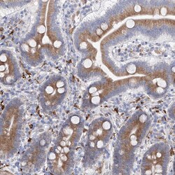 Invitrogen LCLAT1 Polyclonal Antibody 100 &mu;L; Unconjugated:Antibodies,