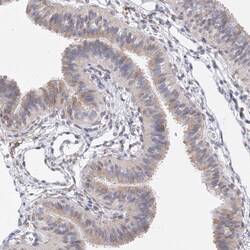 Invitrogen LCLAT1 Polyclonal Antibody 100 &mu;L; Unconjugated:Antibodies,