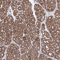 Invitrogen LCLAT1 Polyclonal Antibody 100 &mu;L; Unconjugated:Antibodies,