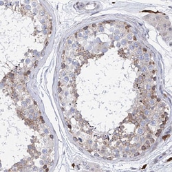 Invitrogen LCLAT1 Polyclonal Antibody 100 &mu;L; Unconjugated:Antibodies,