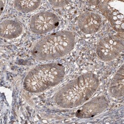 Invitrogen CACNA2D4 Polyclonal Antibody 100 &mu;L; Unconjugated:Antibodies,