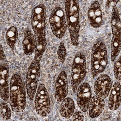Invitrogen COA3 Polyclonal Antibody 100 &mu;L; Unconjugated:Antibodies,