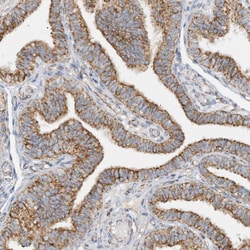 Invitrogen COA3 Polyclonal Antibody 100 &mu;L; Unconjugated:Antibodies,