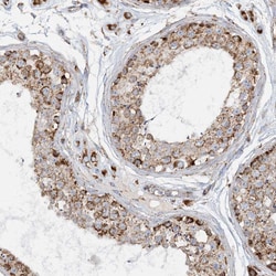 Invitrogen COA3 Polyclonal Antibody 100 &mu;L; Unconjugated:Antibodies,