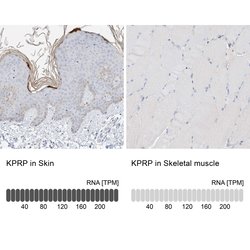 Invitrogen KPRP Polyclonal Antibody 100 &mu;L; Unconjugated:Antibodies,