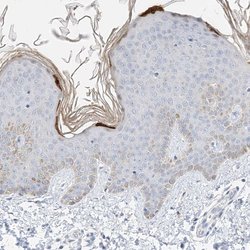 Invitrogen KPRP Polyclonal Antibody 100 &mu;L; Unconjugated:Antibodies,