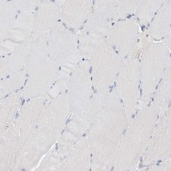 Invitrogen KPRP Polyclonal Antibody 100 &mu;L; Unconjugated:Antibodies,