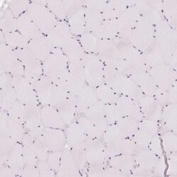 Invitrogen KPRP Polyclonal Antibody 100 &mu;L; Unconjugated:Antibodies,