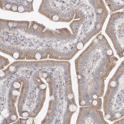 Invitrogen MMGT1 Polyclonal Antibody 100 &mu;L | Buy Online | Invitrogen&trade; | Fisher Scientific