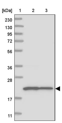 Invitrogen CLNS1A Polyclonal Antibody 100 &mu;L; Unconjugated:Antibodies,