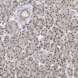 Invitrogen SF3A3 Polyclonal Antibody 100 &mu;L; Unconjugated:Antibodies,