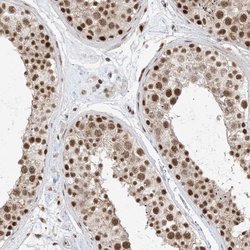 Invitrogen SF3A3 Polyclonal Antibody 100 &mu;L; Unconjugated:Antibodies,