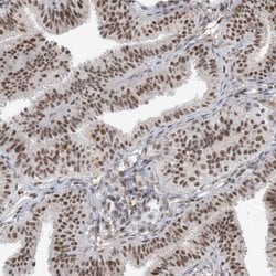Invitrogen SF3A3 Polyclonal Antibody 100 &mu;L; Unconjugated:Antibodies,
