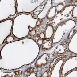 Invitrogen KLHDC9 Polyclonal Antibody 100 &mu;L; Unconjugated:Antibodies,