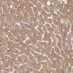 Invitrogen LSS Polyclonal Antibody 100 &mu;L; Unconjugated:Antibodies,