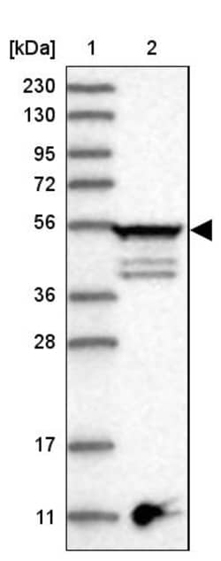 Invitrogen TUBE1 Polyclonal Antibody 100 &mu;L | Buy Online | Invitrogen&trade; | Fisher Scientific