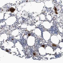 Invitrogen GPATCH3 Polyclonal Antibody 100 &mu;L; Unconjugated:Antibodies,
