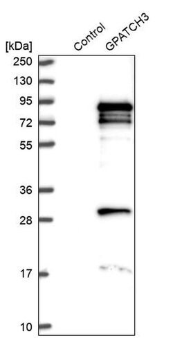 Invitrogen GPATCH3 Polyclonal Antibody 100 &mu;L; Unconjugated:Antibodies,