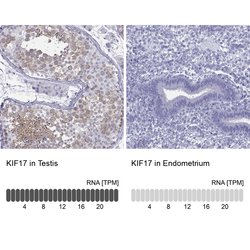 Invitrogen KIF17 Polyclonal Antibody 100 &mu;L; Unconjugated:Antibodies,