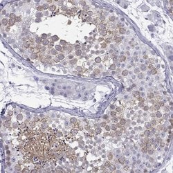 Invitrogen KIF17 Polyclonal Antibody 100 &mu;L; Unconjugated:Antibodies,
