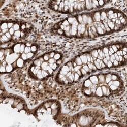 Invitrogen TATDN3 Polyclonal Antibody 100 &mu;L; Unconjugated:Antibodies,