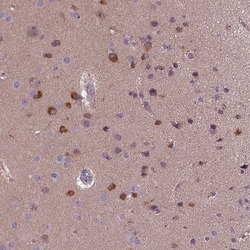 Invitrogen Kazrin Polyclonal Antibody 100 &mu;L; Unconjugated:Antibodies,