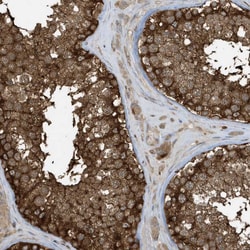 Invitrogen CLCN6 Polyclonal Antibody 100 &mu;L; Unconjugated:Antibodies,