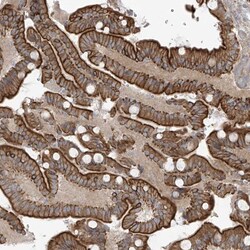 Invitrogen NAV3 Polyclonal Antibody 100 &mu;L; Unconjugated:Antibodies,