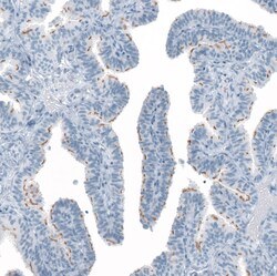 Invitrogen FAM161A Polyclonal Antibody 100 &mu;L; Unconjugated:Antibodies,