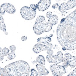 Invitrogen FAM161A Polyclonal Antibody 100 &mu;L; Unconjugated:Antibodies,