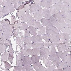 Invitrogen FAM161A Polyclonal Antibody 100 &mu;L; Unconjugated:Antibodies,