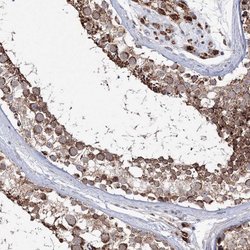 Invitrogen PEX13 Polyclonal Antibody 100 &mu;L; Unconjugated:Antibodies,